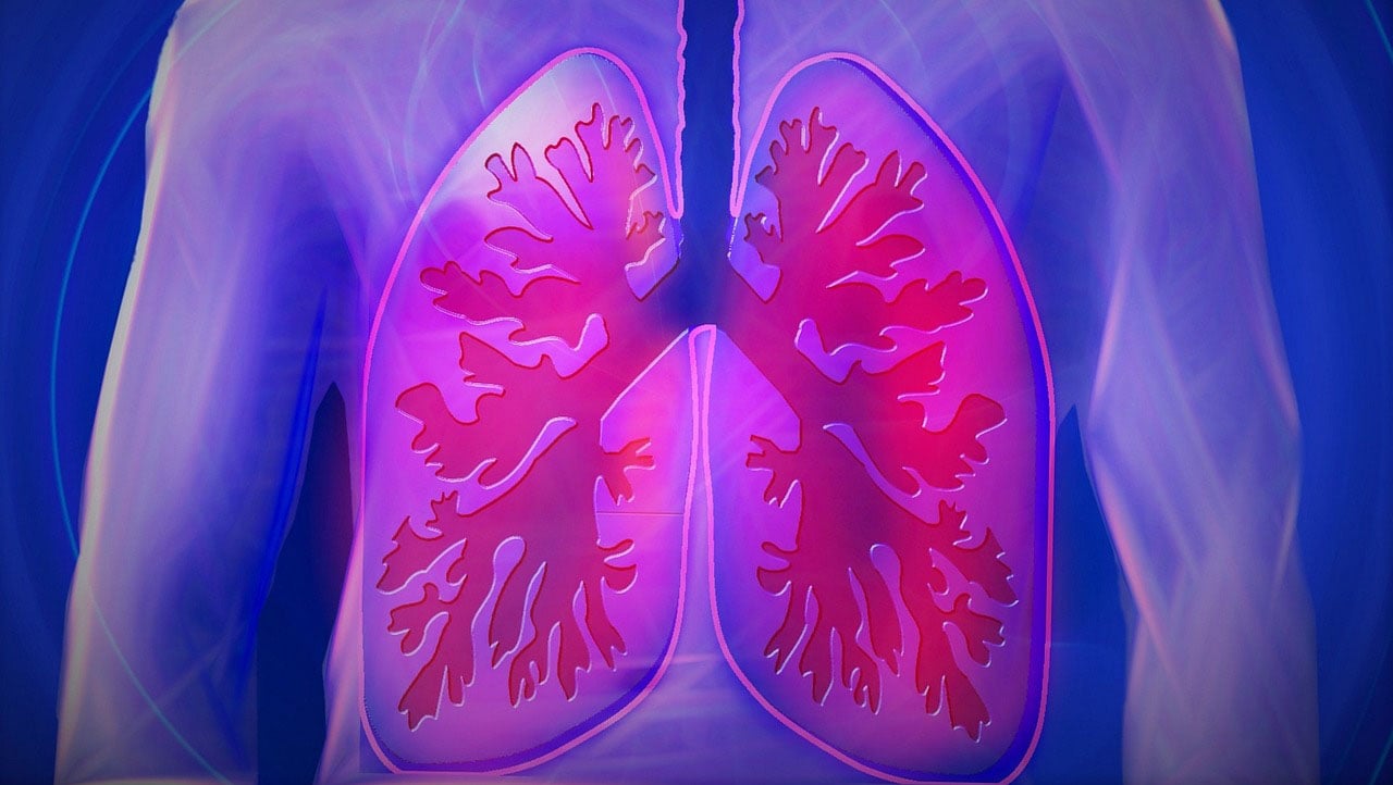 Low-Dose CT Lung Cancer Screening Guidelines | HAP